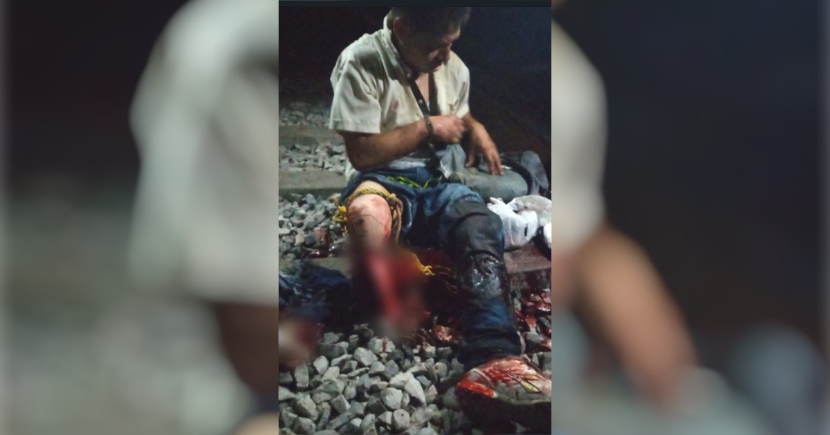 FOTOS: Joven pierde una pierna tras quedarse dormido en vías del tren de Tampico