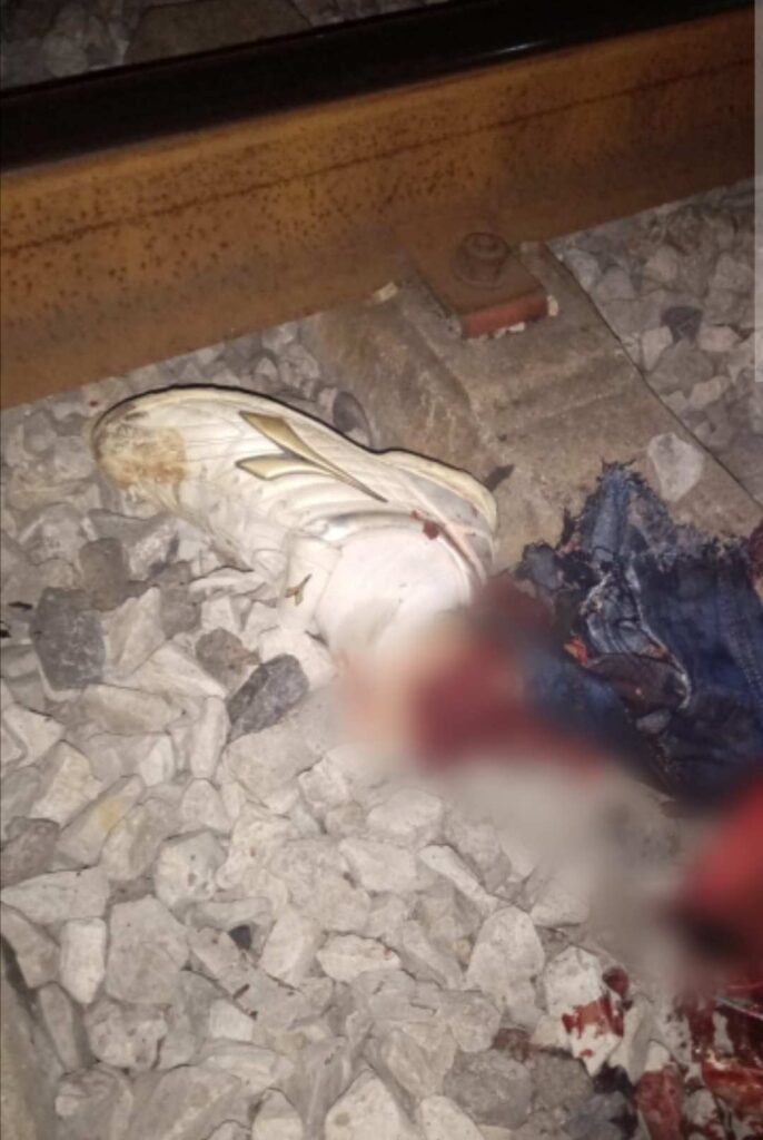 FOTOS: Joven pierde una pierna tras quedarse dormido en vías del tren de Tampico 