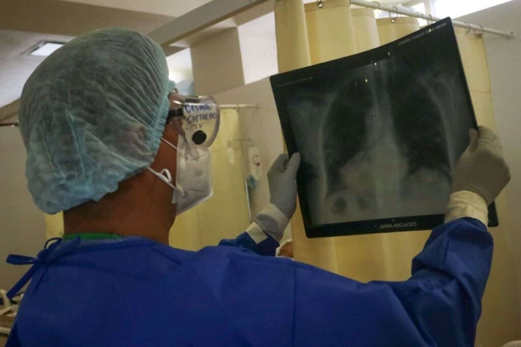 Aumentan casos de tuberculosis en Tamaulipas