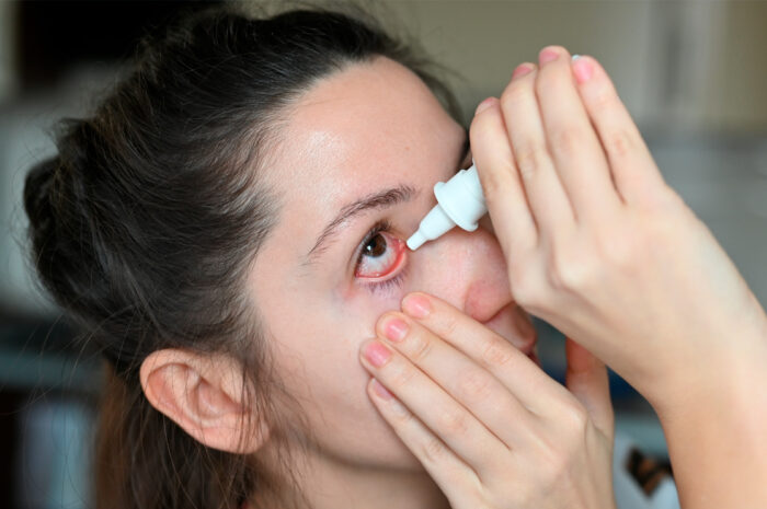 Descartan brote de conjuntivitis en Tamaulipas pese a tercer lugar nacional